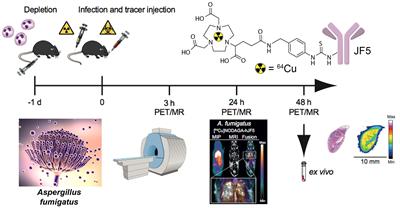 Molecular Imaging of Invasive Pulmonary Aspergillosis Using ImmunoPET/MRI: The Future Looks Bright